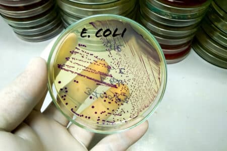 Texas E. coli Lawyer