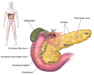 Pancreatic Cancer Class Action Lawsuit