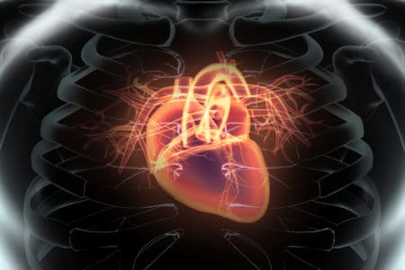 Texas Datascope Intra-Aortic Balloon Pump Lawyer