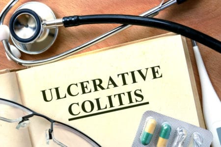 Texas Ulcerative Colitis Lawyer