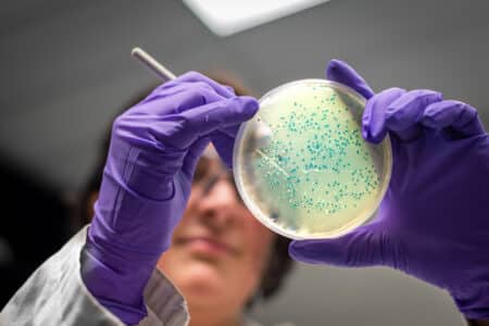 Texas Company Recalls Snowfruit Products for Listeria Risk