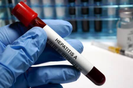 Hepatitis A Recall