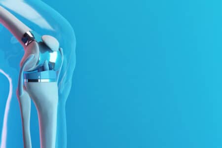 Knee Implant Lawsuit