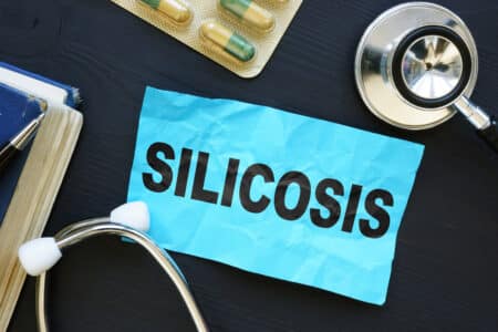 Silicosis Lawsuit